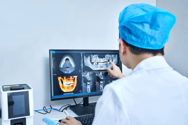 Best Emergency Wisdom Teeth Removal in Waterman, IL